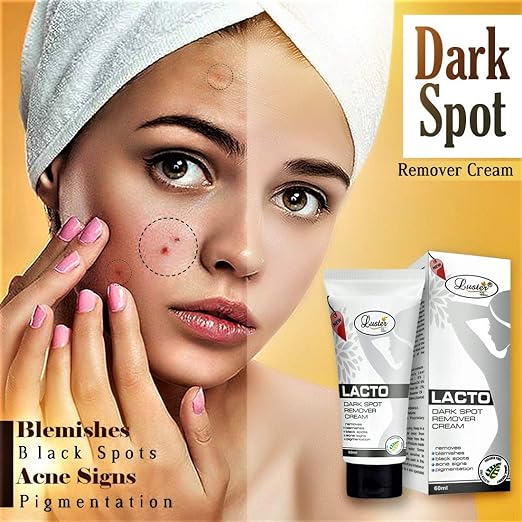 lacto dark spot remover cream