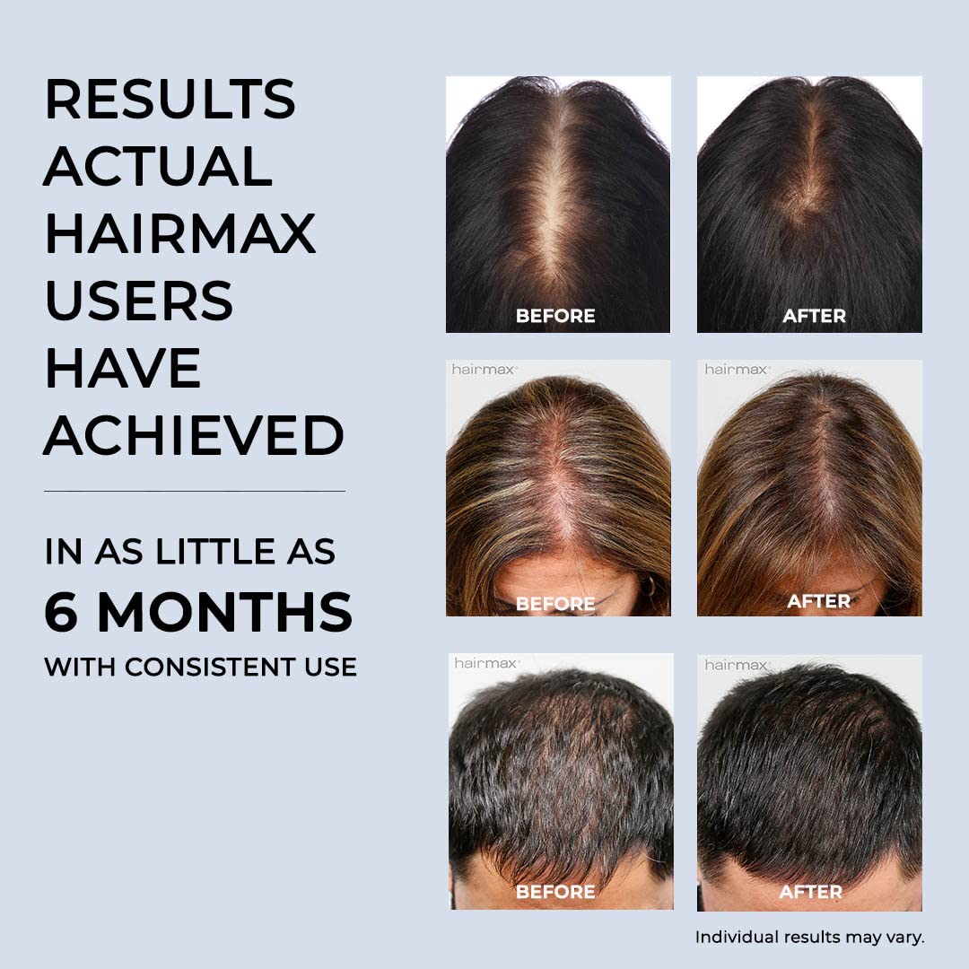 Hairmax Laser Band 41 - (FDA Cleared) Hair Growth Device - Restores Natural Hair Cycle with Red Light Therapy