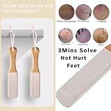 Msxenophile 3Pcs Pumice Stone Foot File for Hard Skin Calluses Pedicure view 5