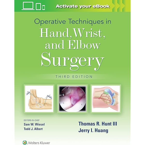 健康・医学 Wide Awake Hand Surgery and Therapy Tips Amazon.com: Wide Awake Hand Surgery and Therapy Tips eBook