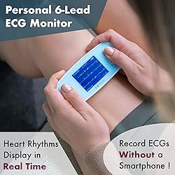 EMAY 6L Portable ECG Monitor | Record ECG and Heart