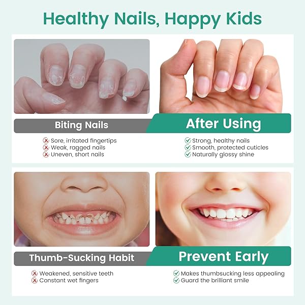 NAIL BITING TREATMENT FOR KIDS & ADULTS | ROLL-ON STOP THUMB SUCKING NAIL POLISH | QUICK-DRY, WATER-RESISTANT NO BITE NAIL POLISH FOR NAIL BITING PREVENTION WITH PORTABLE LANYARD FOR ON-THE-GO USE