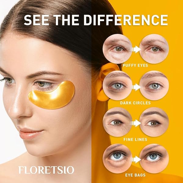 UNDER EYE PATCHES FOR DARK CIRCLES – 24K GOLD COLLAGEN COOLING GEL EYE MASK WITH RETINOL & HYALURONIC ACID, JET LAG SUPPORT, REDUCES PUFFY EYES & FINE LINES DELAYS AGING TREATMENT WOMEN/MEN(30 PAIRS)