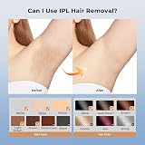 LUBEX 21J IPL Hair Removal Device, 3-in-1, 999,900 Flashes, Gold view 6