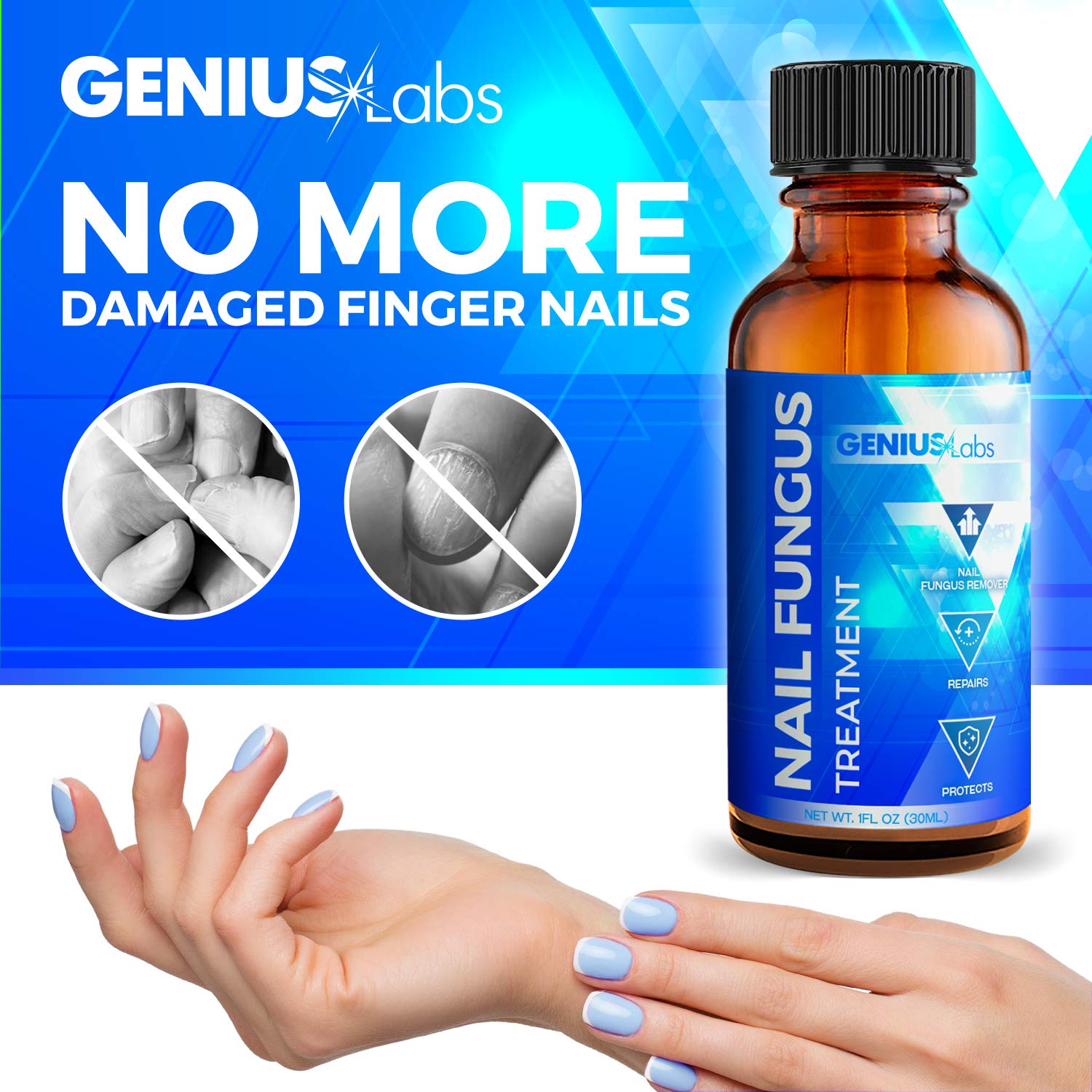 GENIUS Nail Fungus Treatment - Fungal Repair For Thick Toenails, Fingernails & Toenails, Repairs and Protects from Discoloration, Solution For Brittle and Cracked Nails 1oz : Beauty