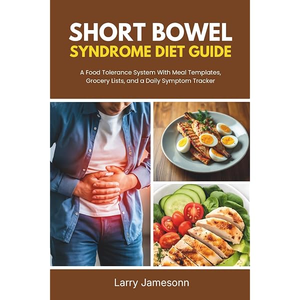 Short Bowel Syndrome: Practical Approach to Management: DiBaise