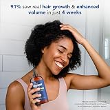 Botanic Hearth Rosemary Oil for Hair Growth 473 ml view 6