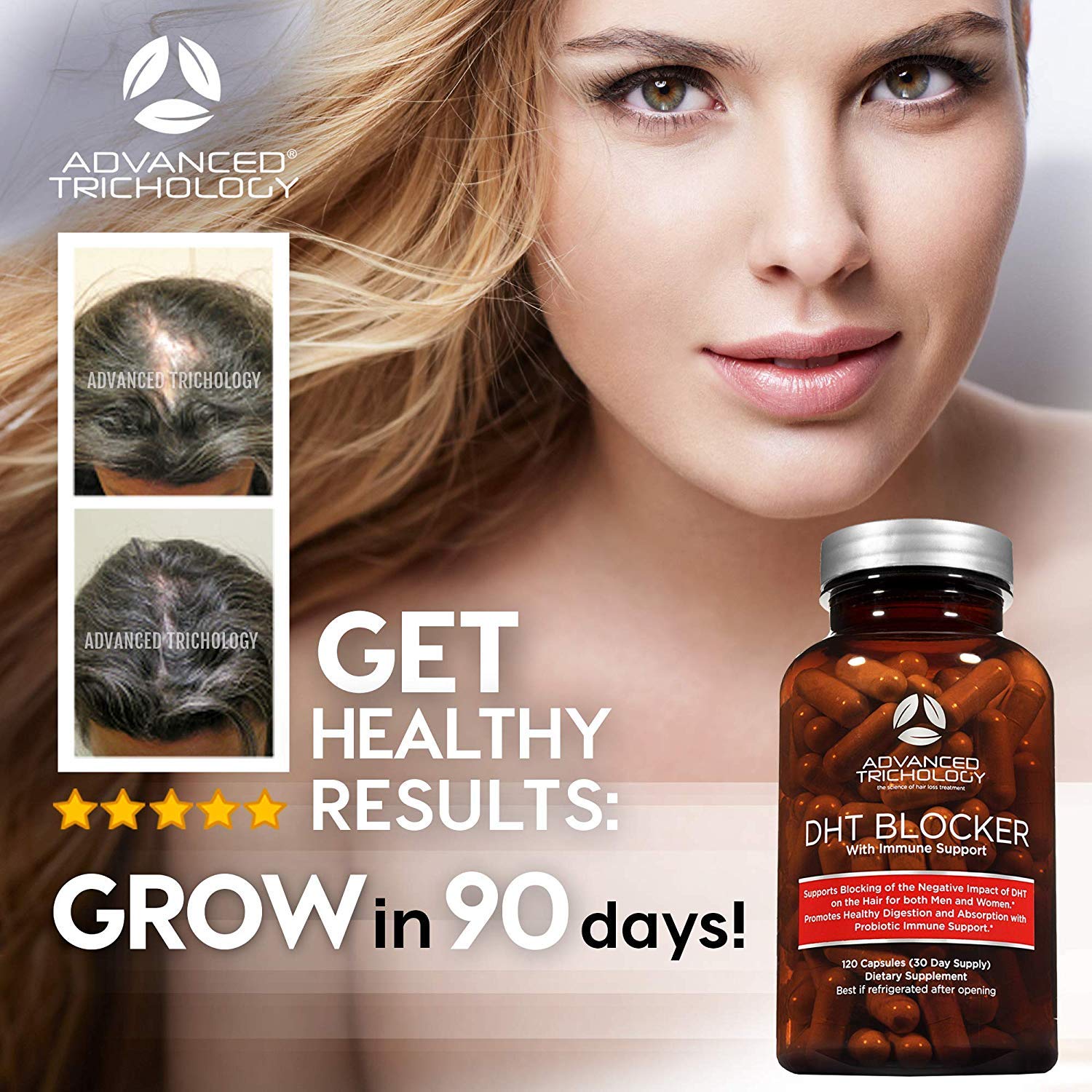 Advanced Trichology Dht Blocker With Immune Support Hair Loss