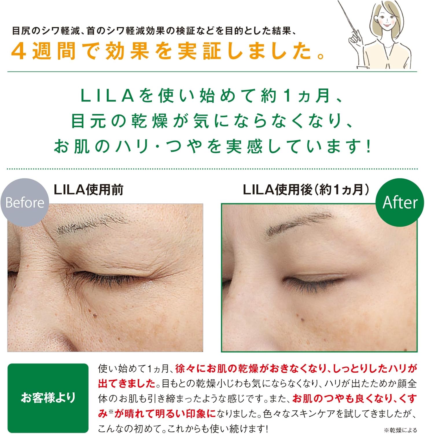 Amazon アイクリーム Lilaスキンケアクリーム 馬プラセンタ 特殊コラーゲン配合 目元たるみ シワ改善 口元 首周り 乾燥シワ対策 北海道産 g 2本 アイケア 美容 保湿クリーム ザナチュラルホッカイドー 乳液 クリーム 通販