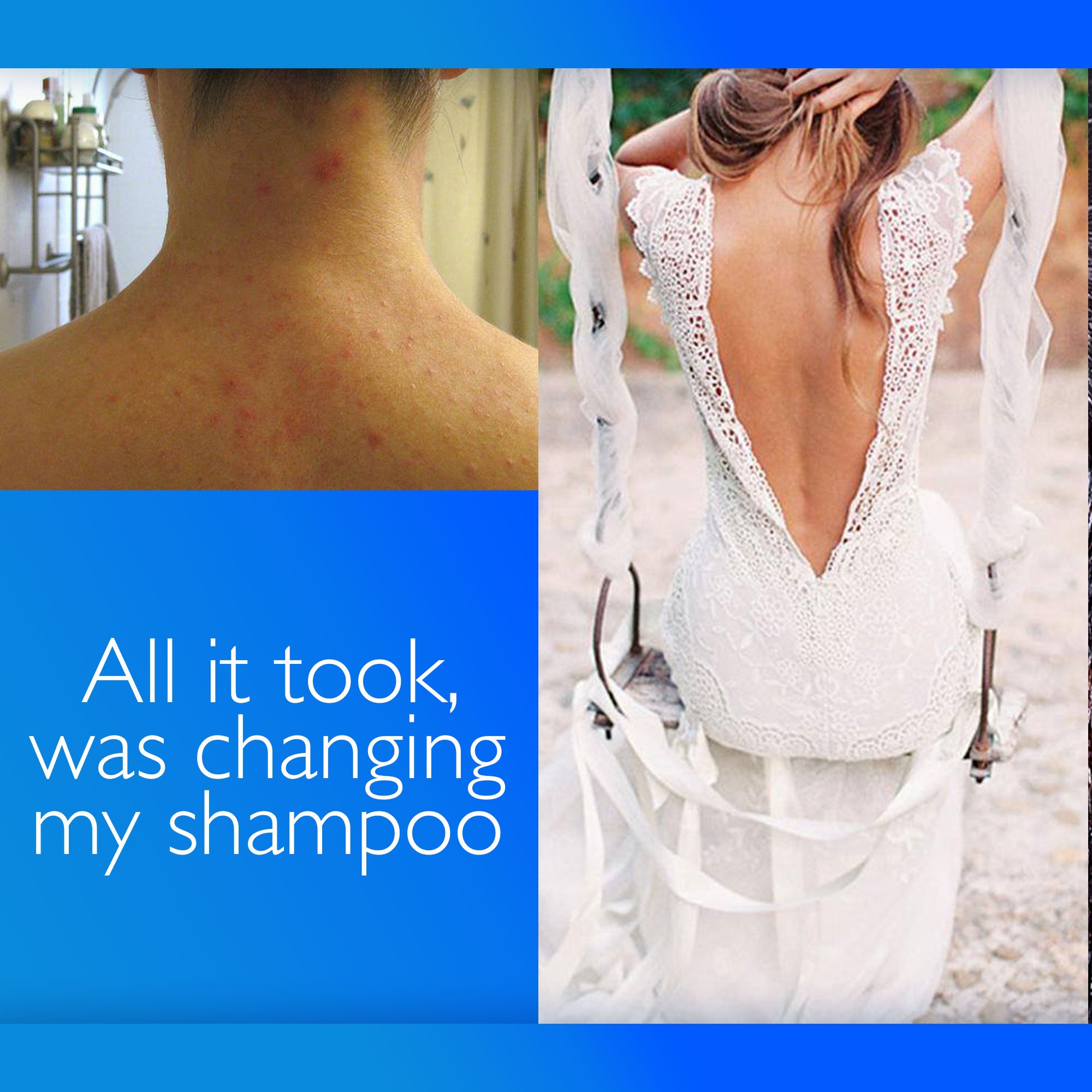 Hair Conditioner for Blemish Free Skin by Clear 2