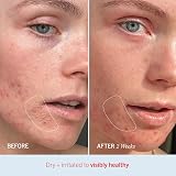 First Aid Beauty Ultra Repair Cream 170g Intense Hydration Skin Barrier view 5