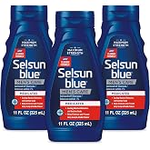 Selsun Blue Medicated Anti-dandruff Shampoo with Menthol, 11 fl. oz., Maximum Strength, Selenium Sulfide 1% (Pack of 3)