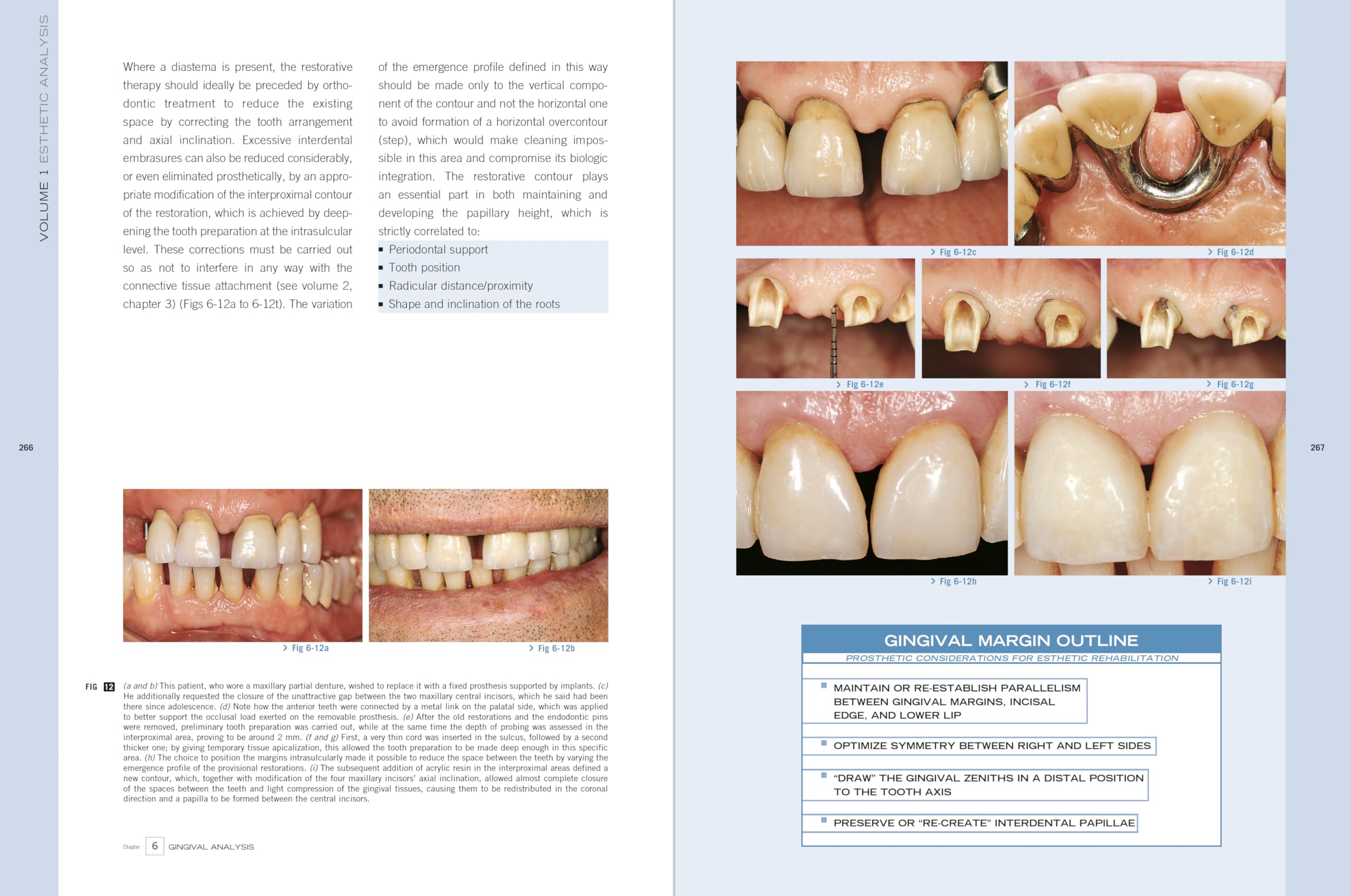 Esthetic Rehabilitation In Fixed Prosthodontics: Esthetic Analysis: A Systematic Approach To Prosthetic Treatment Esthetic Rehabilitation In Fixed Prosthodontics: Esthetic Analysis: A Systematic Approach To Prosthetic Treatment Hardcover