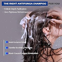 Antifungal Shampoo for Seborrheic