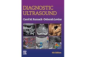 Diagnostic Ultrasound E-Book