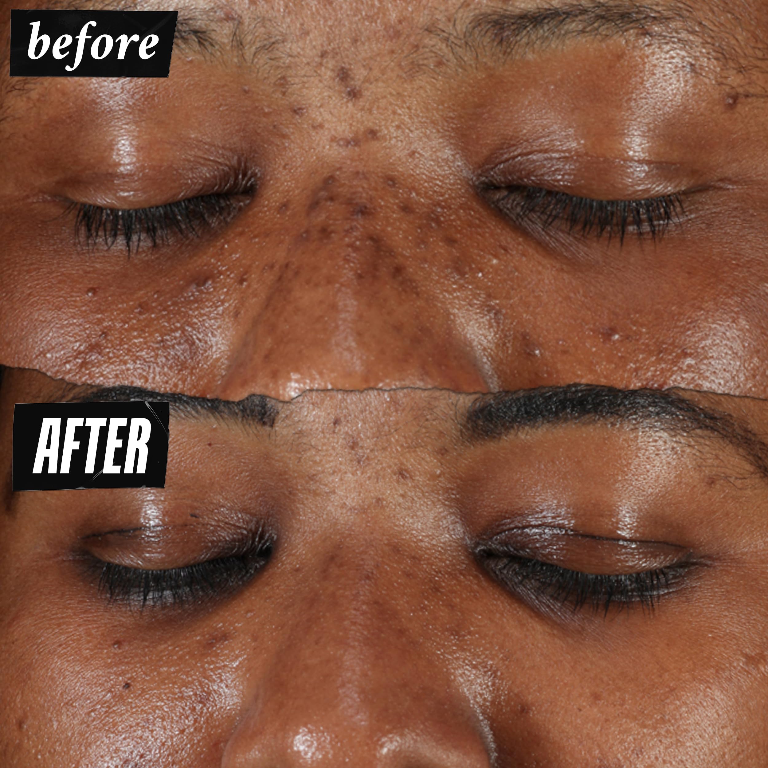 Kiehl's Clearly Corrective Dark Spot Serum, Brightening Facial Serum, Reduces Hyperpigmentation & Post-acne Marks, with Vitamin C & Salicylic Acid, All Skin Types, Paraben-free, Mineral Oil-free