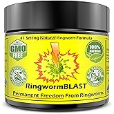 Ringworm Relief Fast Cream Ointment Dermatologist & Lab Tested Better Than Shampoo Adults and Kids Natural Extra Strength No Paraben No Chemicals Hypoallergenic