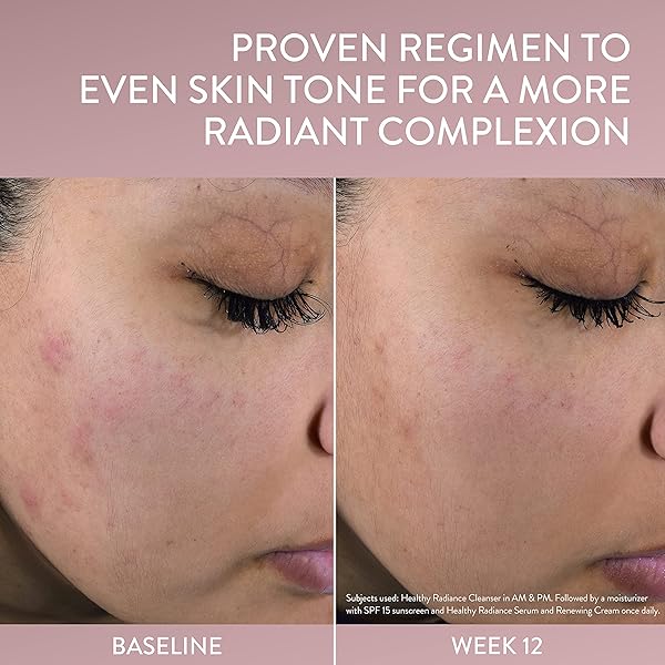 CETAPHIL FACE SERUM, HEALTHY RADIANCE ANTIOXIDANT-C SERUM, VISIBLY REDUCES LOOK OF DARK SPOTS AND HYPERPIGMENTATION, DESIGNED FOR SENSITIVE SKIN, HYPOALLERGENIC, FRAGRANCE FREE, 1 OZ