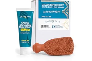 Gilden Tree Foot Callus Remover Kit - 40% Urea Cream & Handmade Terra-Cotta Pumice Stone for Feet - Callus Remover for Feet with Shea Butter & Aloe Vera - Cracked Heel Treatment & Moisturizer