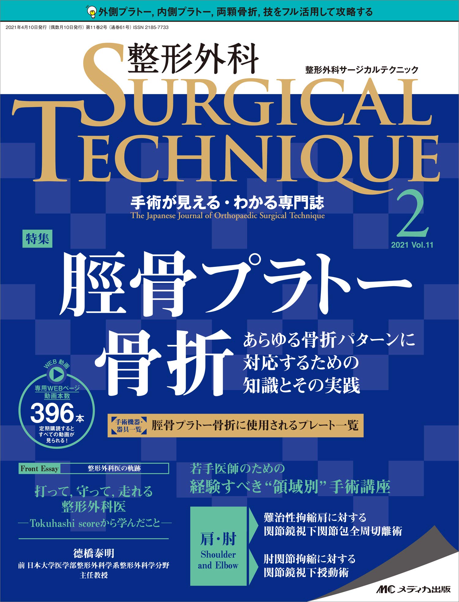 整形外科サージカルテクニック 21年2号 第11巻2号 特集 脛骨プラトー骨折 あらゆる骨折パターンに対応するための知識とその実践 本 通販 Amazon