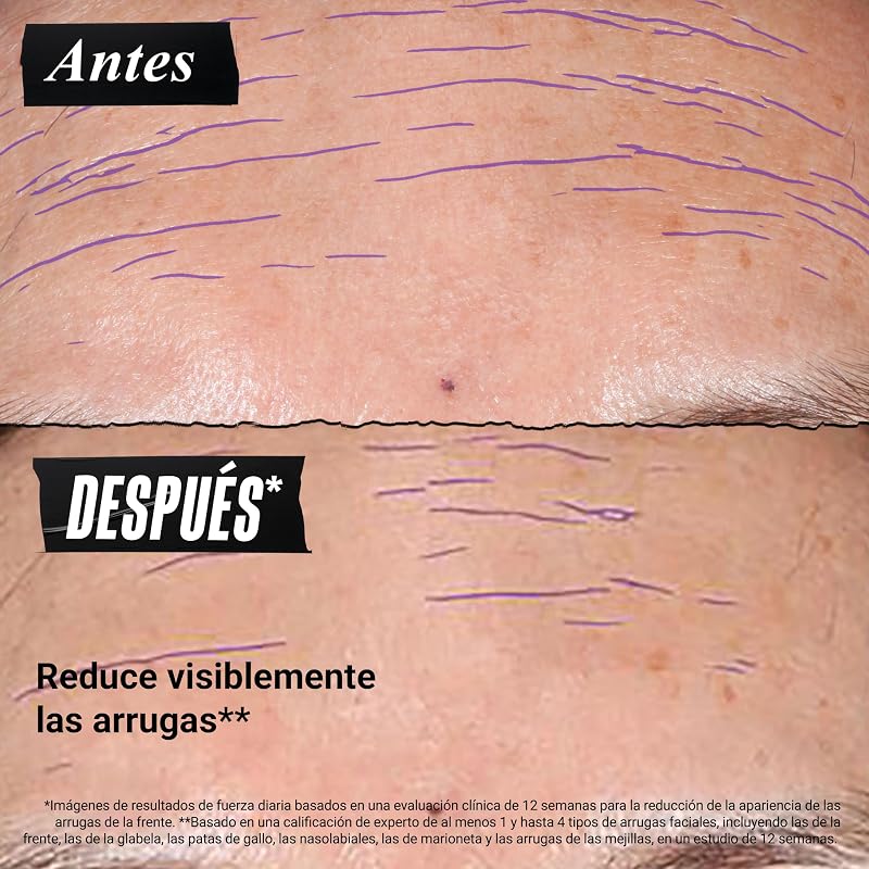 Sérum Anti-Idade Micro-Dose-Renovador de Retinol Diário, 30 ml