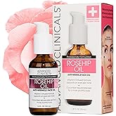 Advanced Clinicals Rosehip Oil For Face With Vitamin E + Botanicals Helps Improve Look Of Dark Spots, Wrinkles, Fine Lines, & Uneven Looking Skin Tone | Moisturizing Skin Care Face Serum, 1.8 Fl Oz