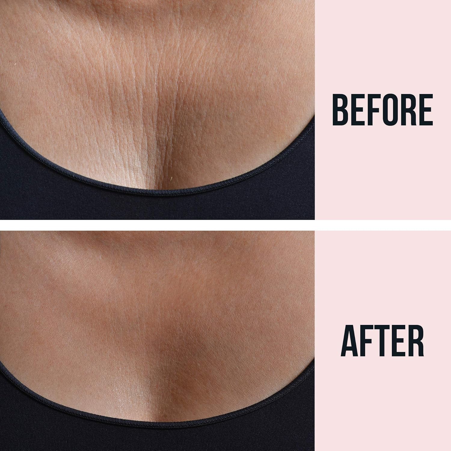 Sio Beauty SkinPad Silicone Chest Anti-Wrinkle Patches (2 Weeks Supply) - Reusable Overnight Smoothing Decollette Pad - Anti-Aging Patch For Neck & Cleavage: Beauty
