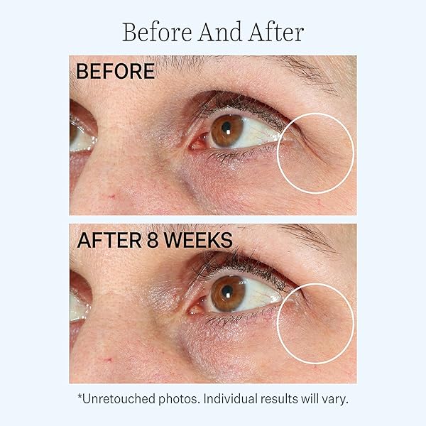 STRIVECTIN CONTOUR RESTORE™ FIRMING MOISTURE BALM FOR EYES, .5 OZ