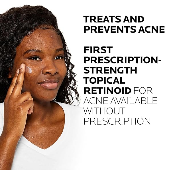 LA ROCHE-POSAY EFFACLAR ADAPALENE GEL 0.1% ACNE TREATMENT, RETINOID CREAM, ACNE MEDICATION GEL FOR BLACKHEADS & WHITEHEADS, OIL FREE, HELPS CLEAR AND PREVENT BLEMISHES & CLOGGED PORES