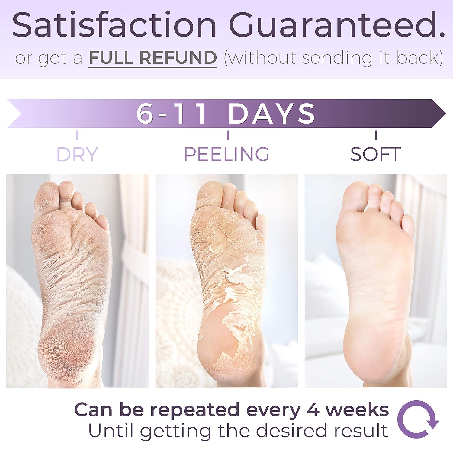 baby foot peel amazon