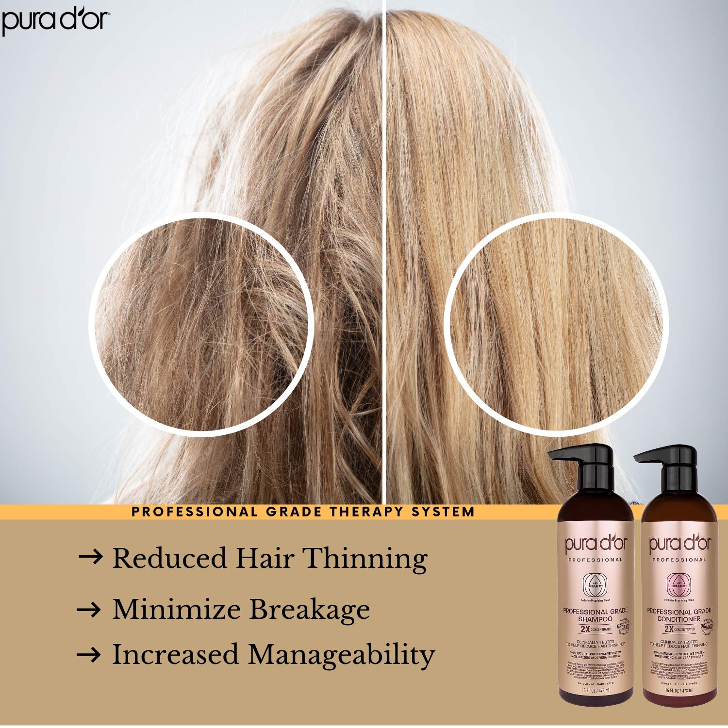 PURA D'OR Professional Grade Anti-Hair Thinning 2X Concentrated Actives Biotin Shampoo & Conditioner (16oz x 2), No Sulfates, Clinically Tested, All Hair Types, Men & Women (Packaging Varies) : Beauty
