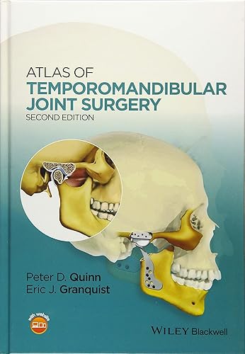 Download Atlas of Temporomandibular Joint Surgery PDF