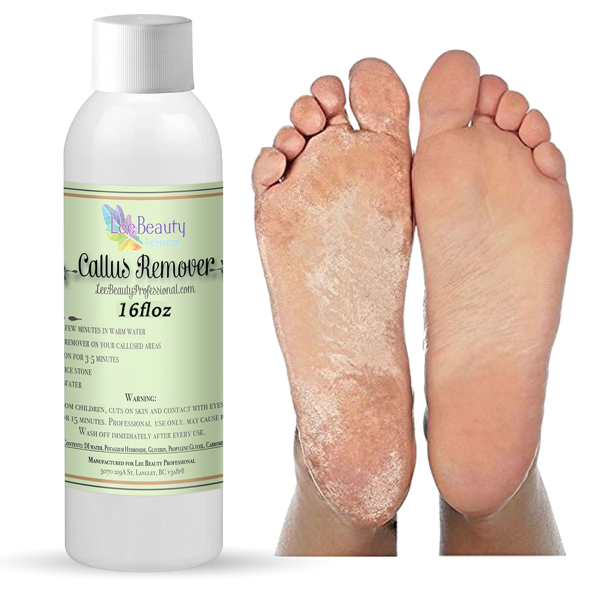 Best Callus Remover.Callus Eliminator,Liquid & Gel For Corn And Callus
