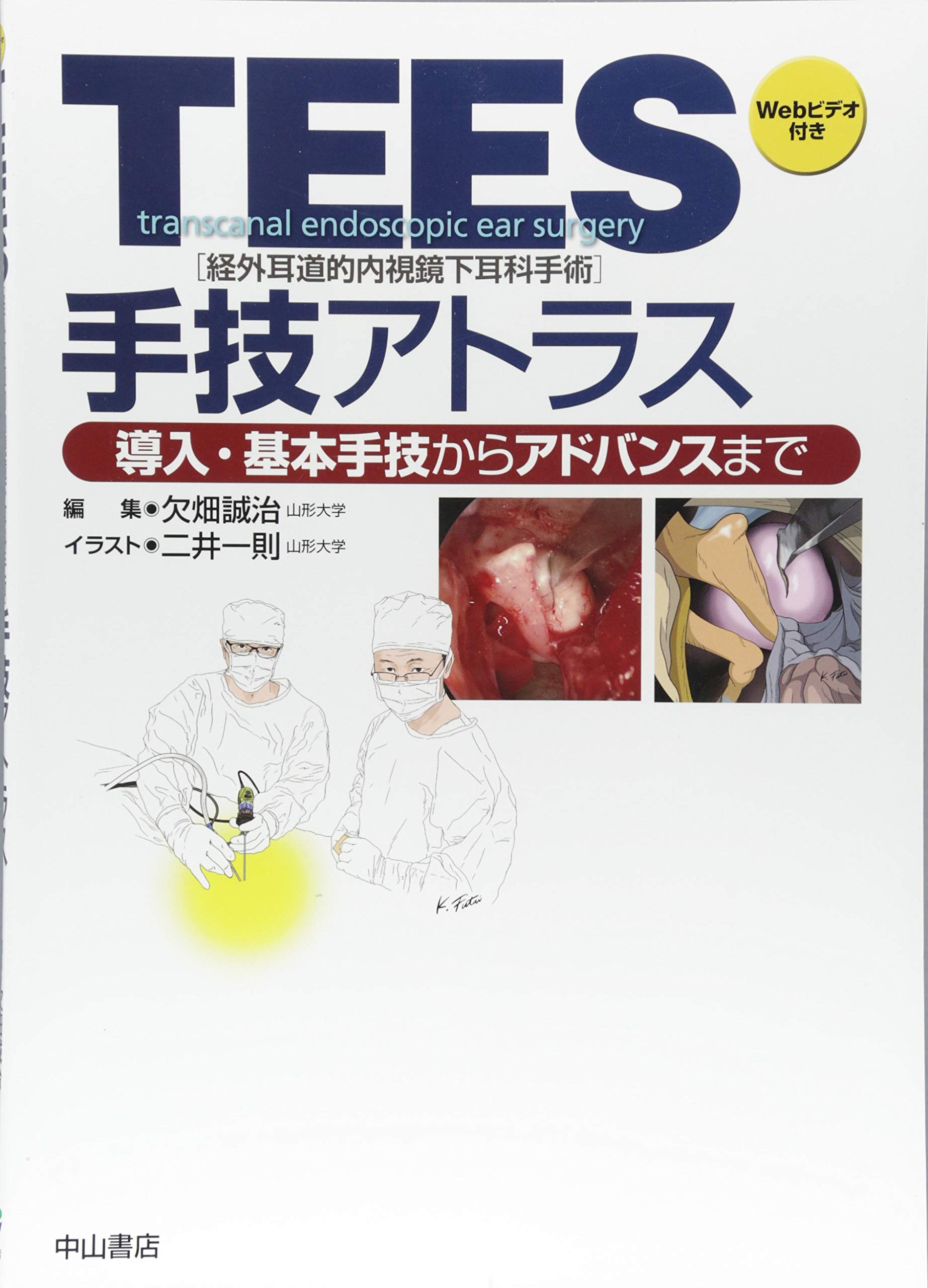 Tees 経外耳道的内視鏡下耳科手術 手技アトラス 欠畑誠治 二井一則 本 通販 Amazon