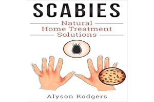 Scabies Natural Home Treatment Solution
