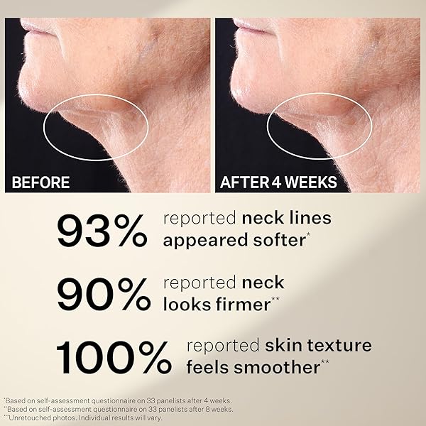 STRIVECTIN TIGHTEN & LIFT PEPTIGHT™ TIGHTENING NECK ANTI-AGING SERUM ROLLER, 1.7 FL. OZ.