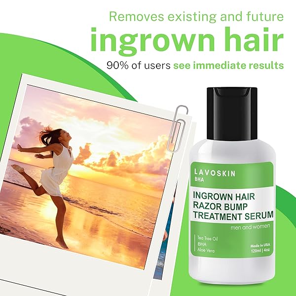 LAVO TEA TREE GEL W/SALICYLIC ACID – BEST INGROWN HAIR TREATMENT – RAZOR BUMP AND BURN REMOVER – BIKINI LINES & ACNE – USE AFTER SHAVING, HAIR REMOVAL, WAXING, LASER, ELECTROLYSIS – FOR MEN AND WOMEN