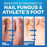 Imperial Feet Athletes Foot Shoe Spray 150 ML Fungal Nail Treatment view 3