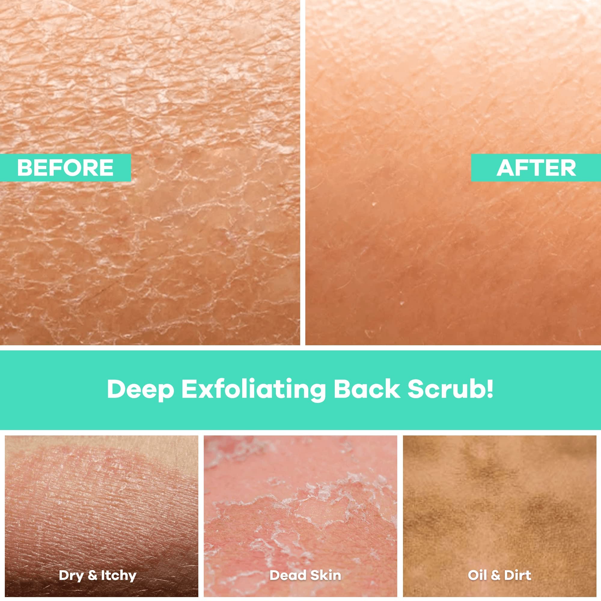 Dermasuri - Deep Exfoliating Back Scrubber - Bath & Shower Back Scrub - Body Exfoliator Scraper Tool - Deep Exfoliation Body Cleaner for Shower - 27