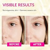 Wake Skincare Reinvigorating Daily Toner Witch Hazel Allantoin Face Oily Skin view 5