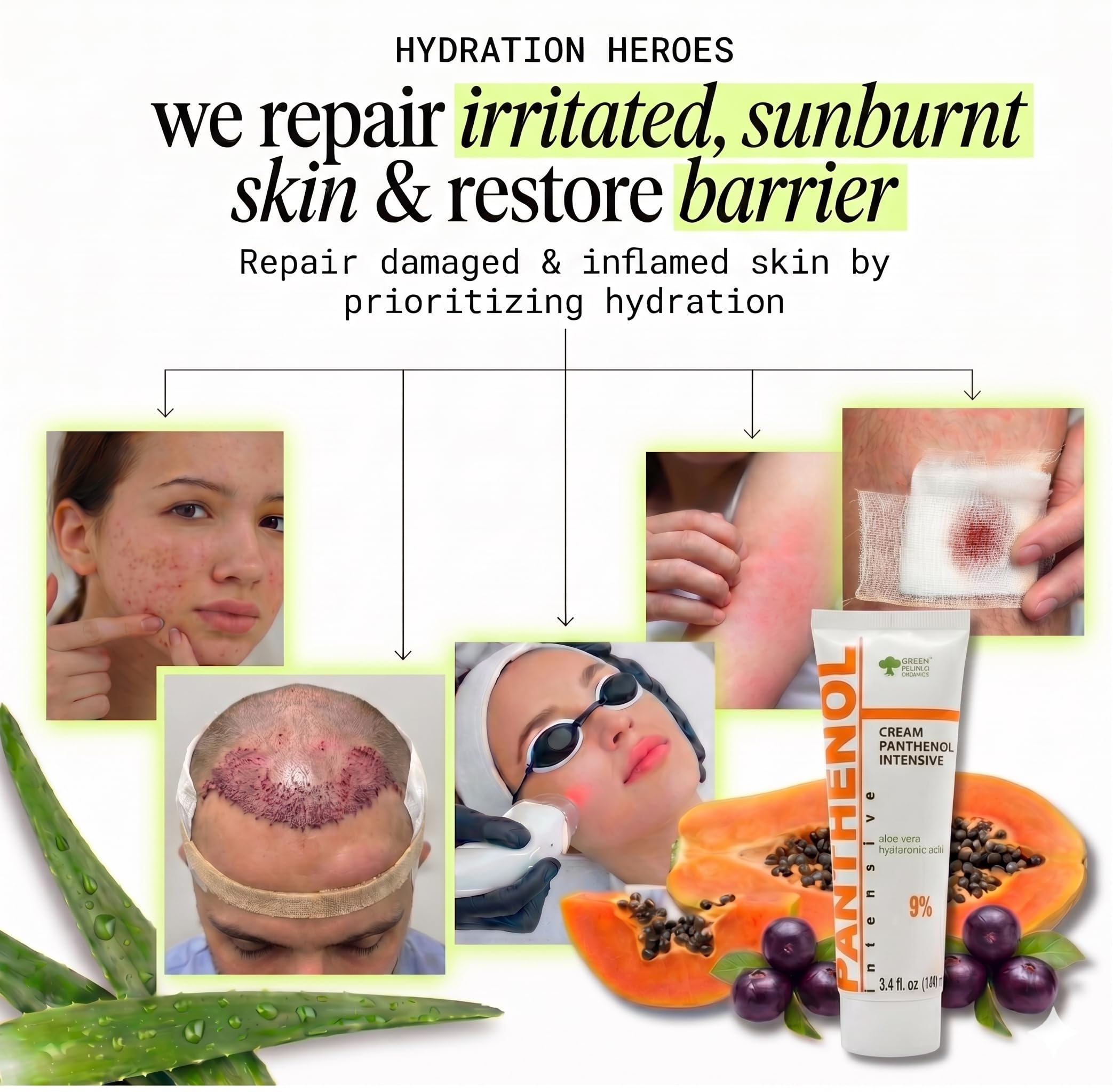 9% Intensive Panthenol-Creme mit Aloe Vera & Hyaluronsäure | Tiefenbefeuchtung, Nach Sonne & Tattoo Pflege, Haartransplantation & Babypflege für alle Hauttypen, 100 ml 5