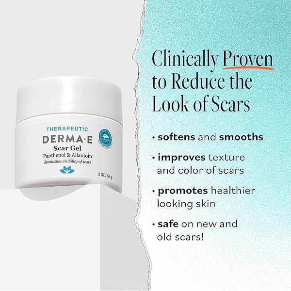 DERMA E SCAR GEL – SCAR TREATMENT FOR FACE – HYDRATING GEL FOR ACNE SCARS, BURNS & STRETCH MARKS WITH PANTHENOL & ALLANTOIN, 2 OZ