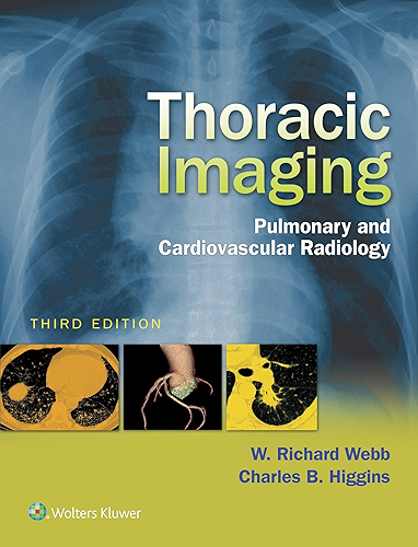 Download Thoracic Imaging: Pulmonary and Cardiovascular Radiology (English Edition) PDF