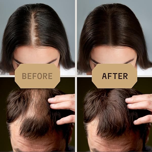 STRIKING VIKING HAIR FIBERS (MEDIUM BLONDE) 28G – NATURALLY DERIVED, LONG-LASTING BUILDING POWDER – UNDETECTABLE FOR THINNING HAIR, FOR MEN & WOMEN