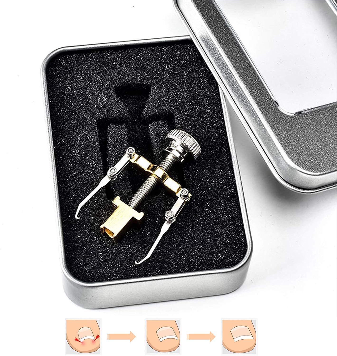 SpinSnips Nail Clipper Set With Rotating Swivel Head For Best Positioning - Stainless Steel Fingernail + Toenail Clippers by Precision Living