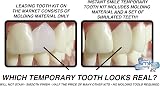 Instant Smile Multishade Temporary Tooth Repair Kit - 30 False Teeth view 7