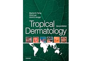 Tropical Dermatology E-Book