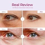 Dr.Melaxin Cemenrete Calcium Patches 60 Eye Patches Dark Circles Puffy view 3