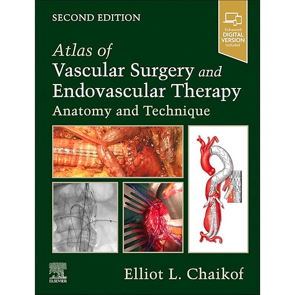 洋書 Surgical and Endovascular Treatment of A 51n6eHcV19L._AC_SY200_QL15_.jpg
