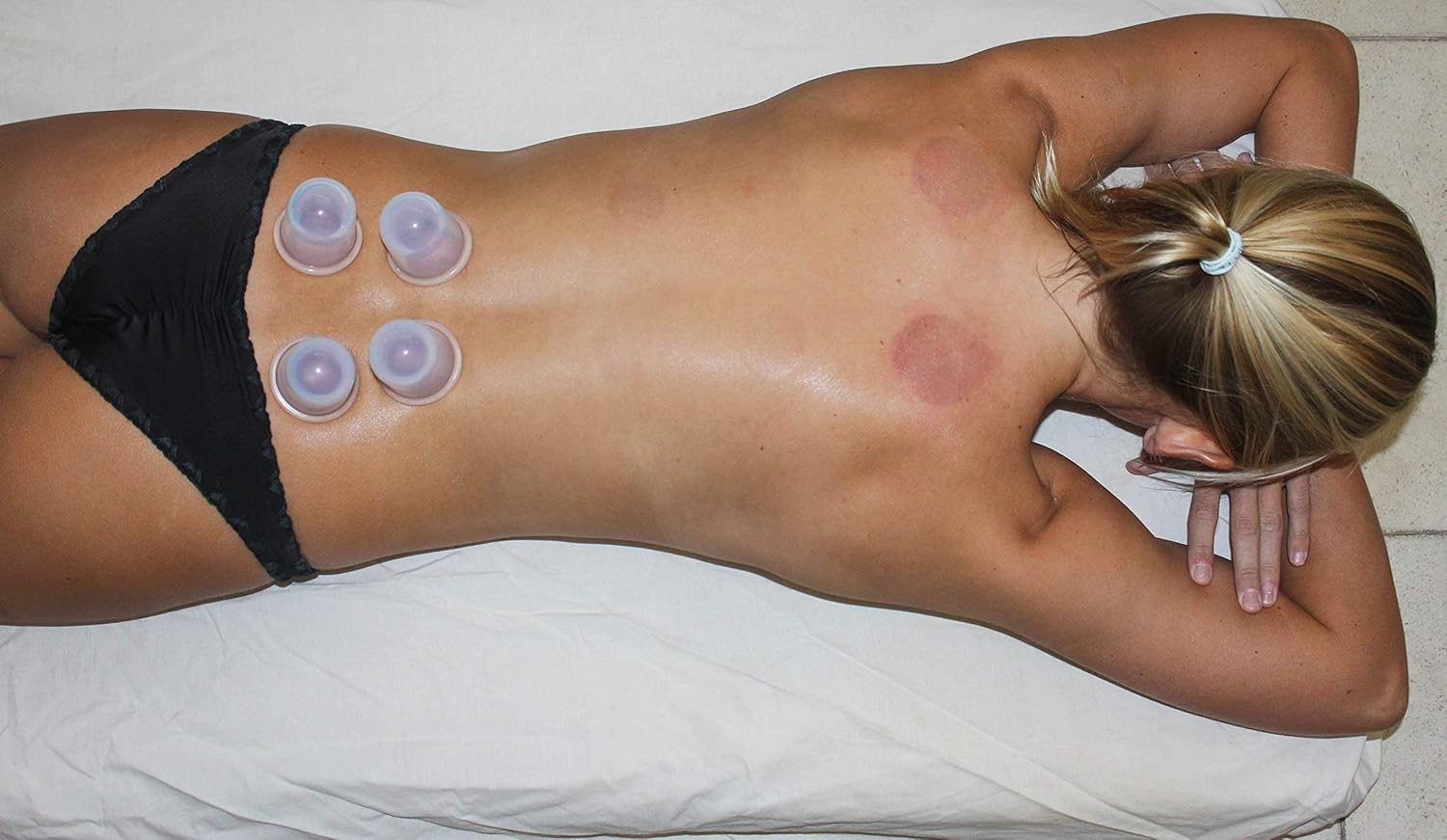 Cupping Set Massage Therapy Cups - by DoSensePro. 6 Flexible Silicone Vacuum Cups. Acupuncture Fireless Cupping Therapy for Arthritis,Pain Relief, Relaxation, Anti-Aging, Anti-Cellulite: Health & Personal Care